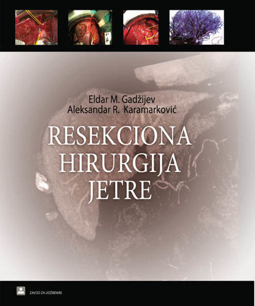 Resekciona hirurgija jetre