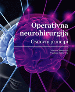 Operativna neurohirurgija : osnovni principi